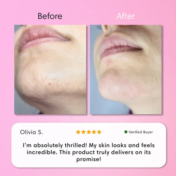 Hair Removal Kit
