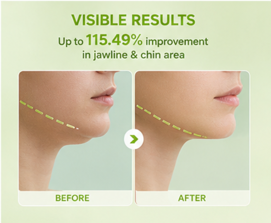 V-Lifting Cooling Jawline Mask 4-Pack